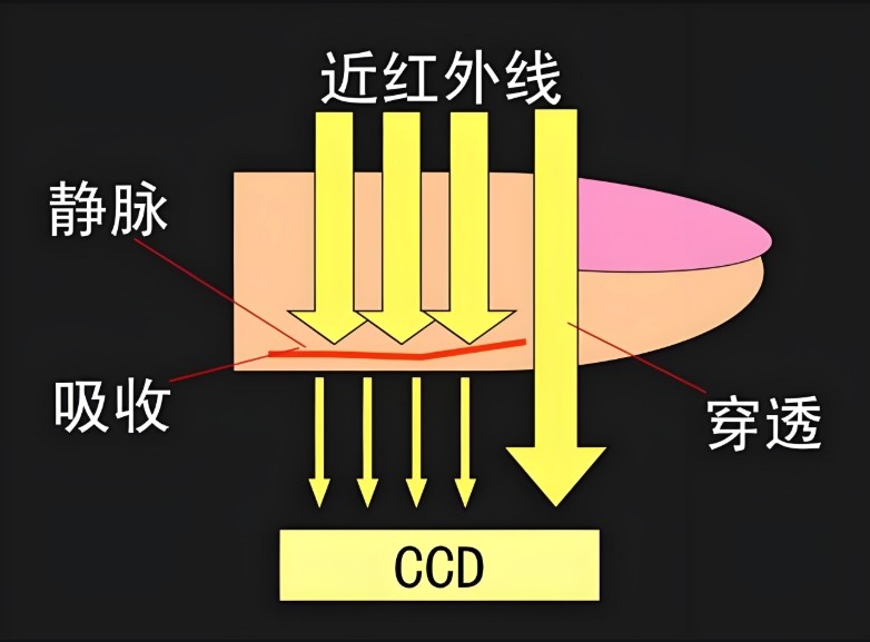 靜脈顯像儀原理